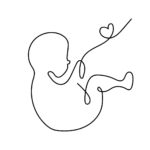 Foetus Foetus